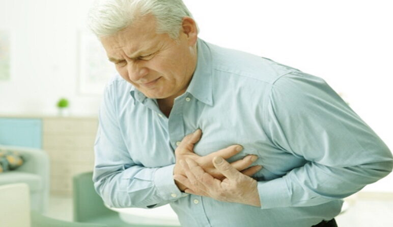 infarctus, infarctus du myocarde, le myocarde, maladies du cœur, athérosclérose,AVC