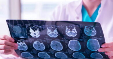 notre cerveau, la santé de notre cerveau