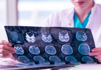 notre cerveau, la santé de notre cerveau