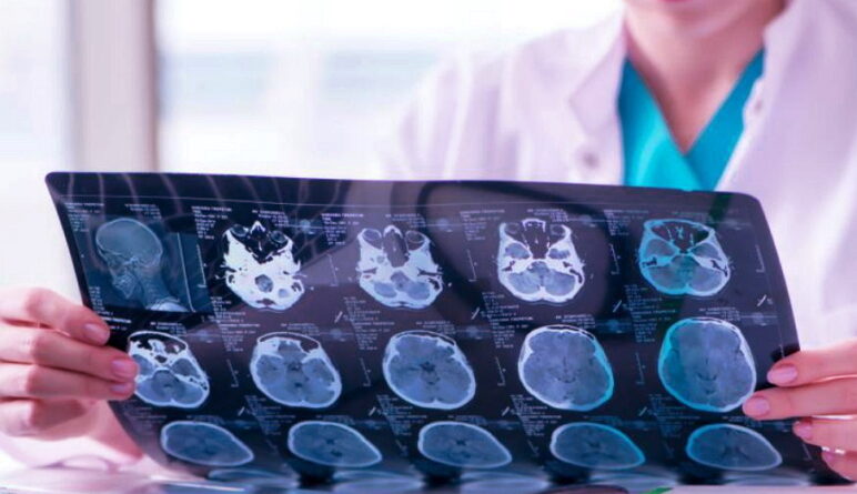 notre cerveau, la santé de notre cerveau
