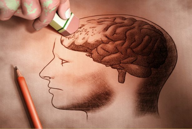 maladie d'Alzheimer, Alzheimer, démence, Parkinson, traitement d'Alzheimer, médicaments Alzheimer