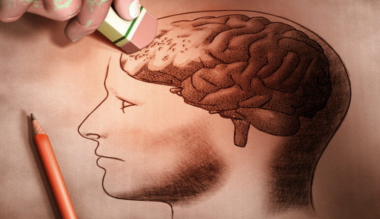 maladie d'Alzheimer, Alzheimer, démence, Parkinson, traitement d'Alzheimer, médicaments Alzheimer