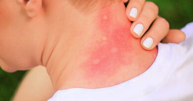 attention aux insectes, tiques, moustiques