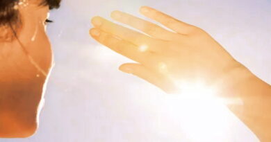 coup de soleil, coups de soleil