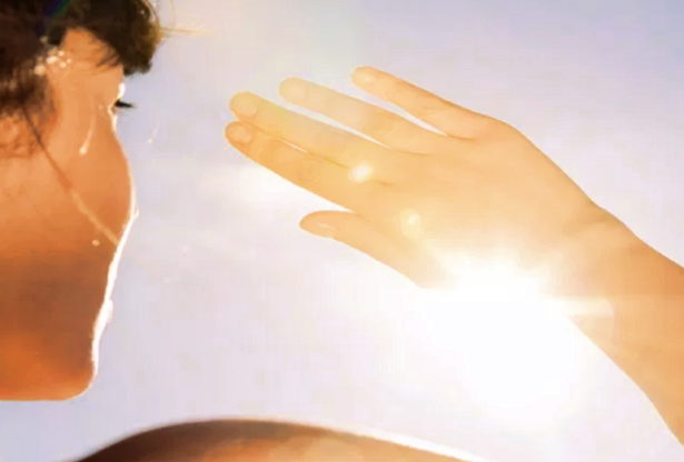 coup de soleil, coups de soleil