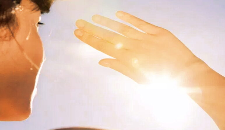 coup de soleil, coups de soleil