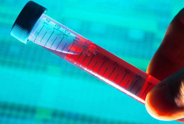 les virus et les bactéries, virus dangereux, bactéries dangereuses