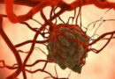 Le cancer n&rsquo;est plus à craindre