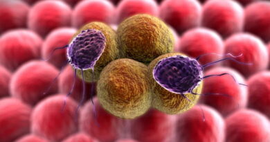 cancer du pancréas, comment traiter le cancer de pancréas
