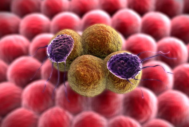 cancer du pancréas, comment traiter le cancer de pancréas