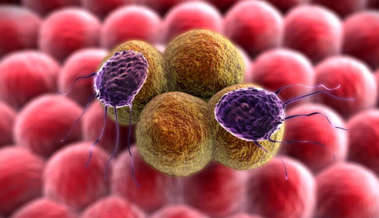 cancer du pancréas, comment traiter le cancer de pancréas