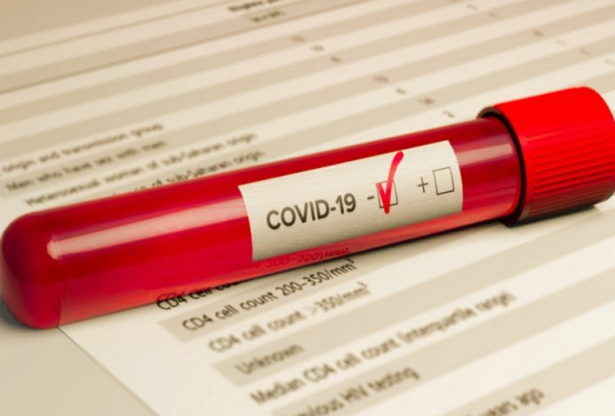 coronavirus, covid-19
