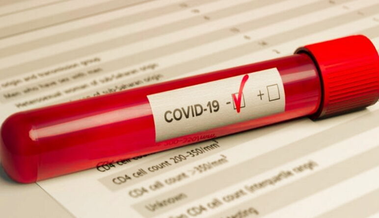 coronavirus, covid-19