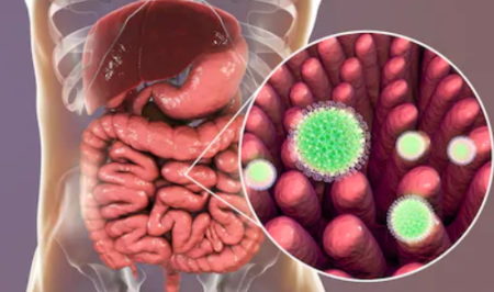 coronavirus, SRAS, Grippe, virus, maladies infectieuses, covid-19, covid, choléra, Ébola
