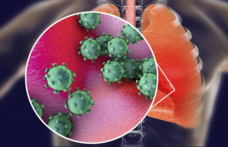 coronavirus, SRAS, Grippe, virus, maladies infectieuses, covid-19, covid, choléra, Ébola