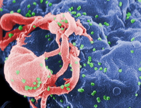 coronavirus, SRAS, Grippe, virus, maladies infectieuses, covid-19, covid, choléra, Ébola