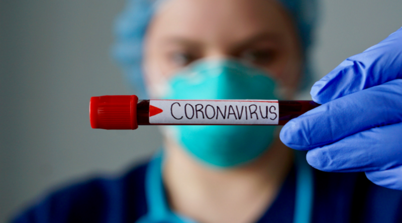 coronavirus, SRAS, Grippe, virus, maladies infectieuses, covid-19, covid, choléra, Ébola