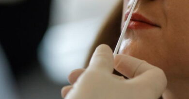 des tests à covid-19, coronavirus, SRAS, Grippe, virus, maladies infectieuses, covid-19, covid, choléra, Ébola