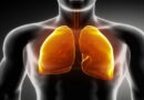 maladies des poumons, pneumonie, les signes de la pneumonie