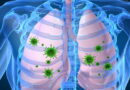 maladies des poumons, pneumonie, les signes de la pneumonie, symptômes de la pneumonie, traitement de la pneumonie, tout sur la pneumonie