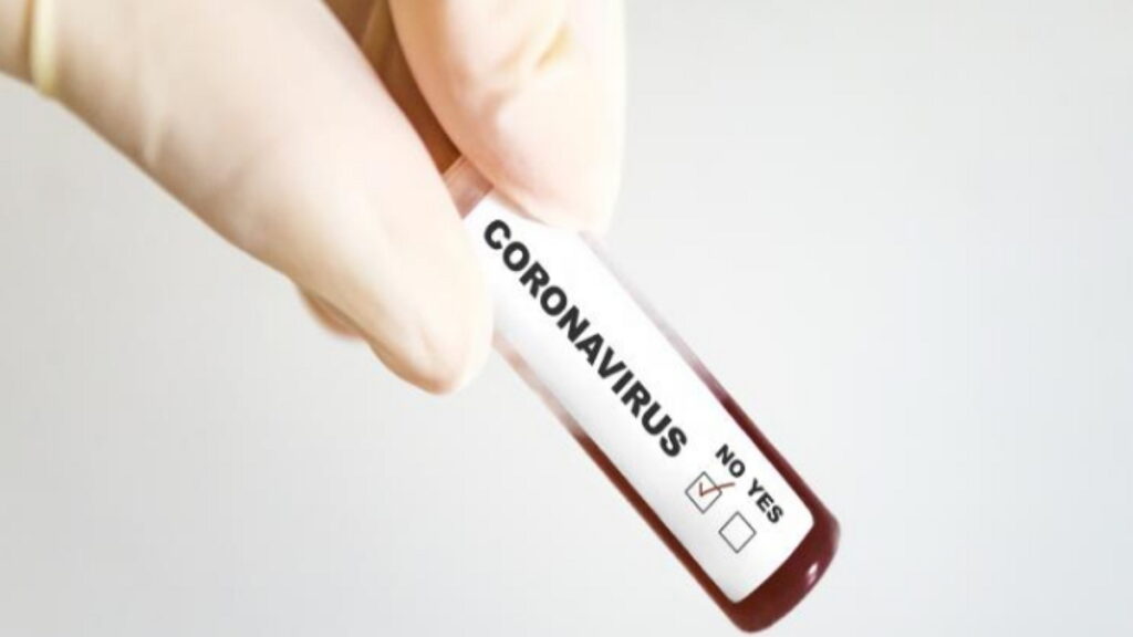 coronavirus, SRAS, Grippe, virus, maladies infectieuses, covid-19, covid, choléra, Ébola