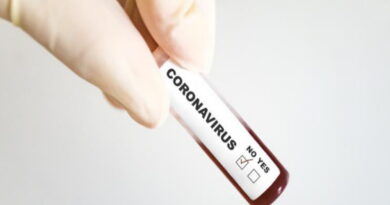 coronavirus, SRAS, Grippe, virus, maladies infectieuses, covid-19, covid, choléra, Ébola