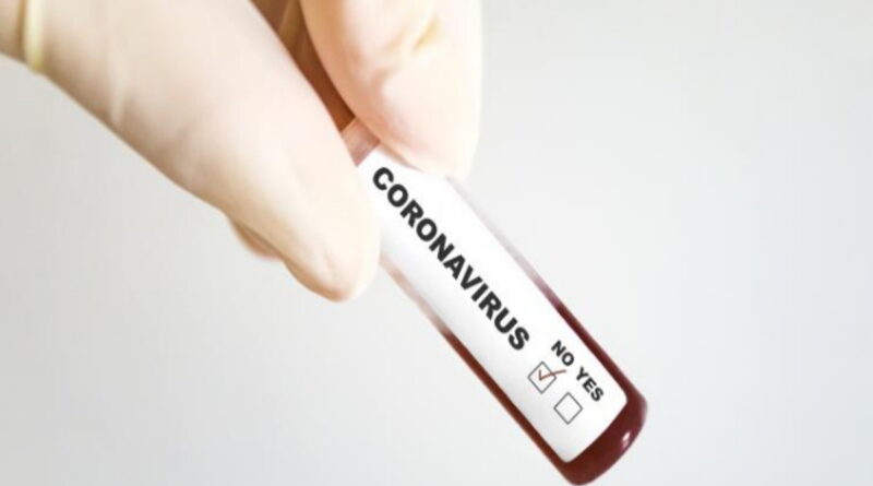 coronavirus, SRAS, Grippe, virus, maladies infectieuses, covid-19, covid, choléra, Ébola