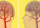 cerveau, Maladies d'Alzheimer, comment s'alimenter, alimenter notre cerveau