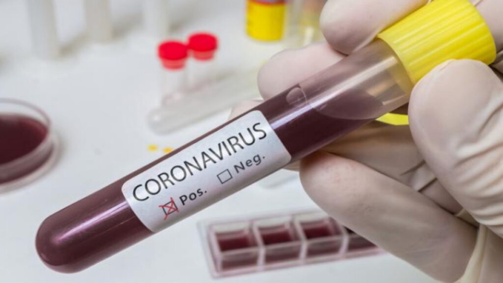 pandémie, épidémie, coronavirus, SRAS, Grippe, virus, maladies infectieuses, covid-19, covid, choléra, Ébola
