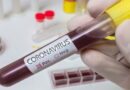 pandémie, épidémie, coronavirus, SRAS, Grippe, virus, maladies infectieuses, covid-19, covid, choléra, Ébola