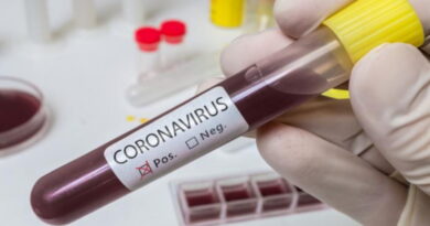 pandémie, épidémie, coronavirus, SRAS, Grippe, virus, maladies infectieuses, covid-19, covid, choléra, Ébola