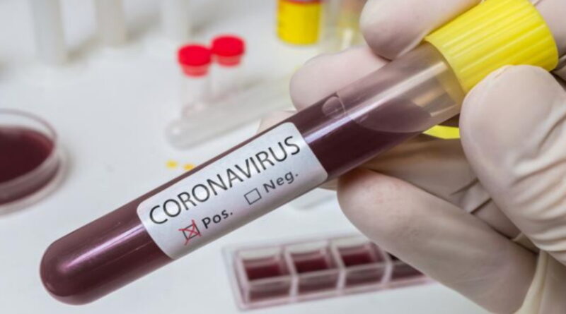 pandémie, épidémie, coronavirus, SRAS, Grippe, virus, maladies infectieuses, covid-19, covid, choléra, Ébola