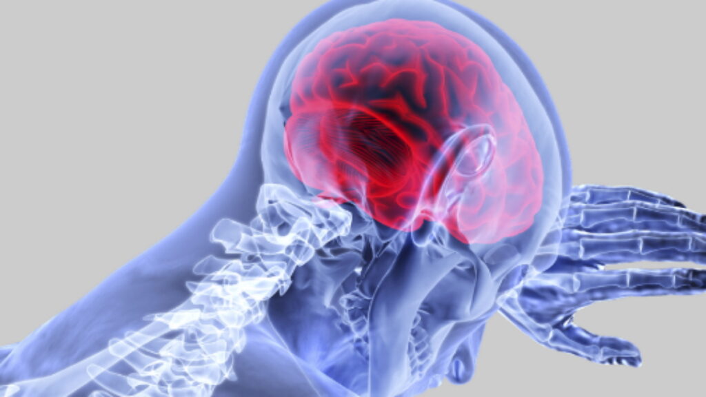 AVC, maladies cardiaques, maladies du cœur, accident vasculaire cérébral, maladies neurologiques,
