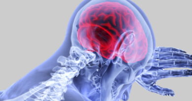 AVC, maladies cardiaques, maladies du cœur, accident vasculaire cérébral, maladies neurologiques,