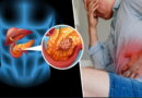 cancer de pancréas, le pancréas, comment se protéger de cancer