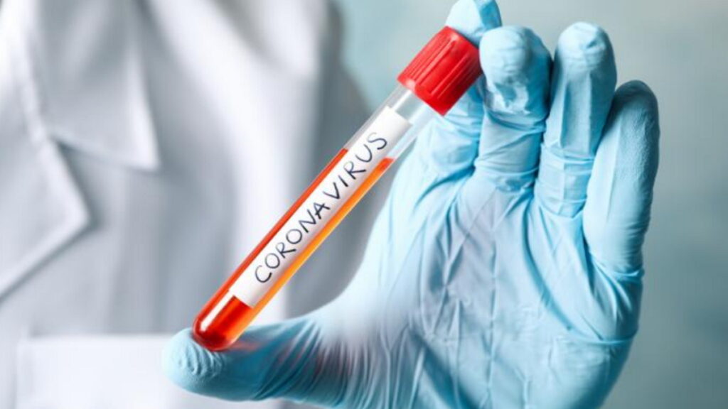 coronavirus, SRAS, Grippe, virus, maladies infectieuses, covid-19, covid, choléra, Ébola