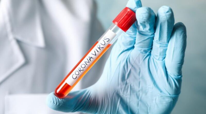 coronavirus, SRAS, Grippe, virus, maladies infectieuses, covid-19, covid, choléra, Ébola