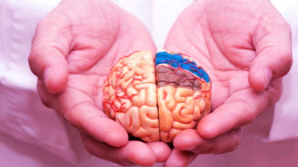 AVC, accident vasculaire, neurologie,