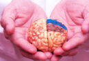 AVC, accident vasculaire, neurologie,