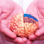 AVC, accident vasculaire, neurologie,