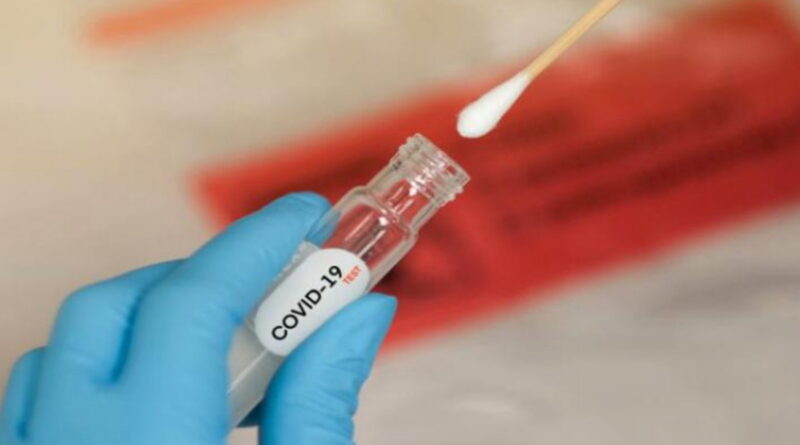 coronavirus, SRAS, Grippe, virus, maladies infectieuses, covid-19, covid, choléra, Ébola