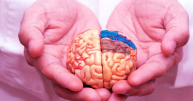 AVC, accident vasculaire, neurologie,