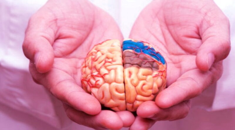 AVC, accident vasculaire, neurologie,