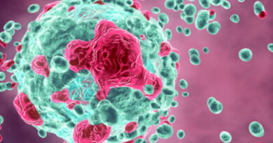 cancer, le cancer, pourquoi apparaît le cancer