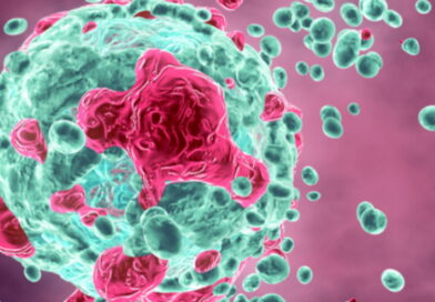 cancer, le cancer, pourquoi apparaît le cancer