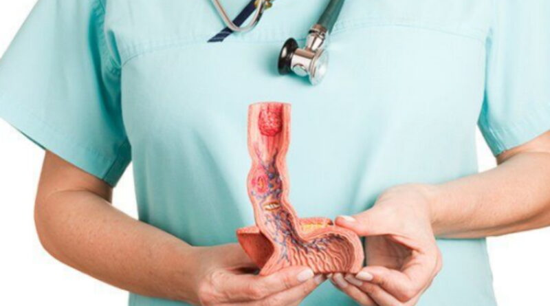 tout sur le cancer de l'œsophage