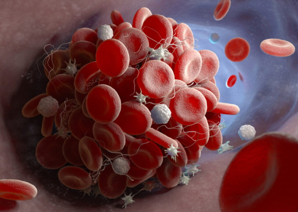 vaccination, coronavirus, SRAS, Grippe, virus, maladies infectieuses, covid-19, covid, choléra, Ébola