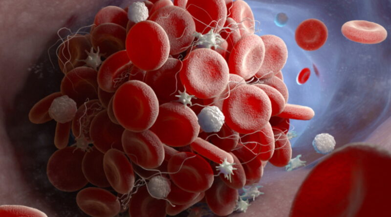 vaccination, coronavirus, SRAS, Grippe, virus, maladies infectieuses, covid-19, covid, choléra, Ébola