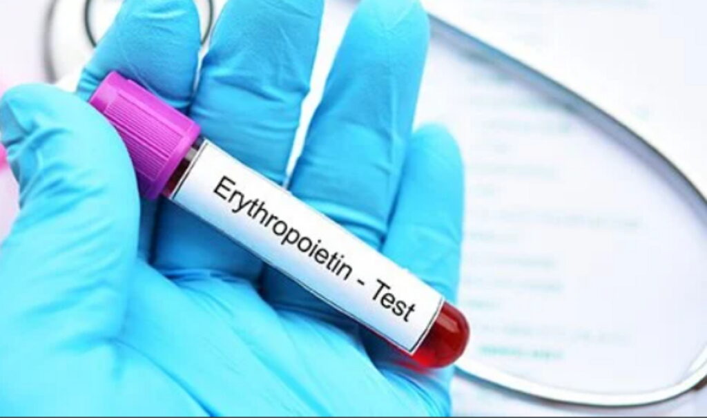 les maladies de sang, érythrocytes