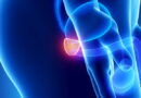 La prévention du cancer de la prostate : conseils et dépistage